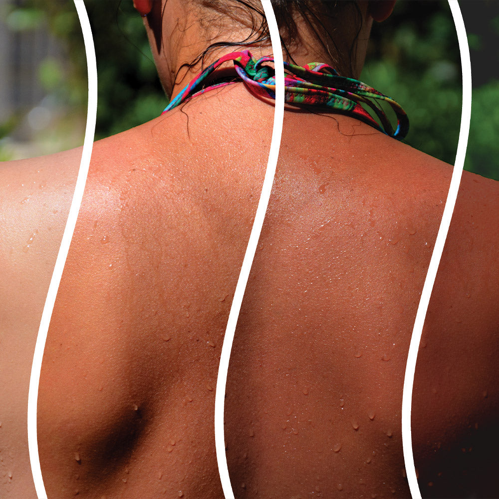 Colorful patterned bikini top strap worn around the neck featured in managing melanin article
