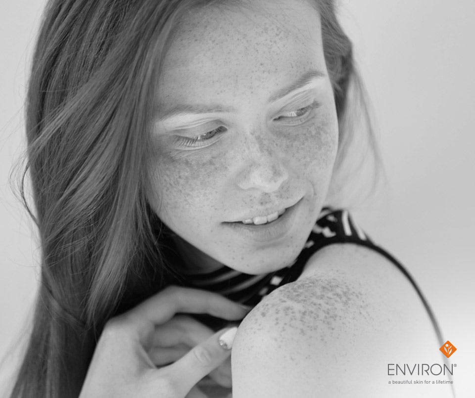 A woman with freckles wearing a black and white striped top for may is skin cancer awareness month