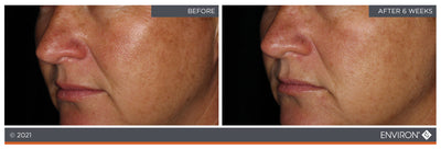 The image shows a before-and-after comparison of skin tone and texture, highlighting the results after six weeks.