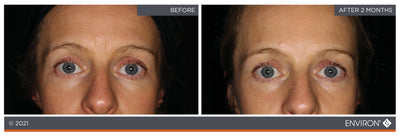 Environ skincare product advertisement featuring before-and-after facial images.