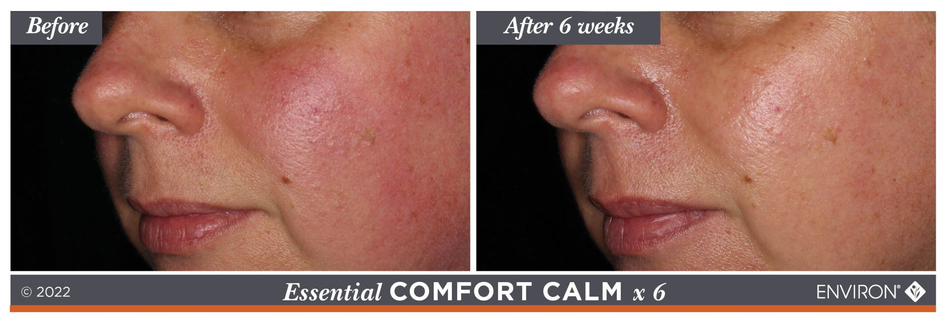 Essential comfort calm x 6 skincare product by enviro.