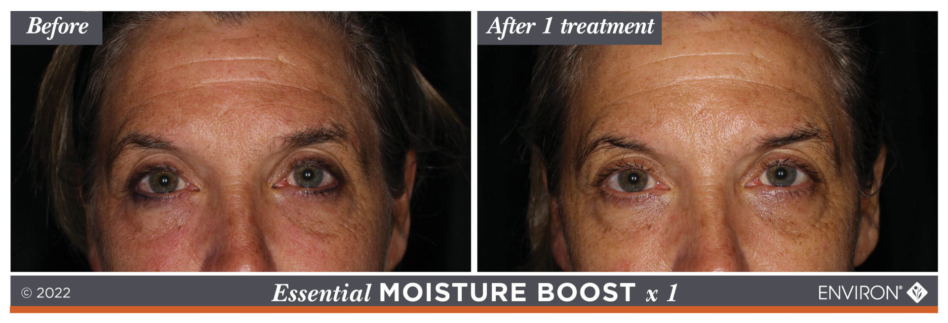Essential moisture boost x1 skincare treatment by environ.