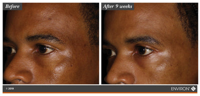 The image shows a before-and-after comparison of skin texture and tone, highlighting the results after nine weeks of use.