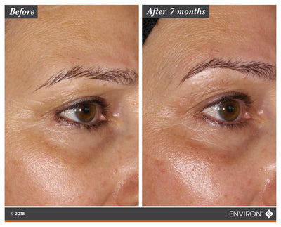 The image shows a before-and-after comparison of an eyebrow, with the ’after 7 months’ side displaying a fuller, more defined brow in dark brown color.