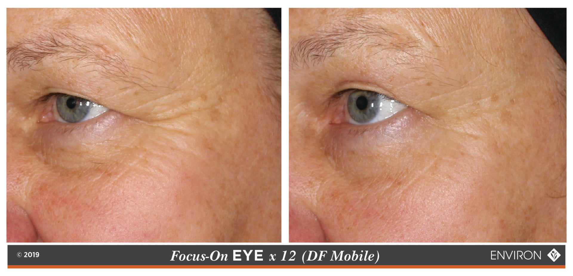 The image displays a split-view comparison of an eye, with the left side showing signs of aging such as wrinkles and discoloration around the eyelid area.