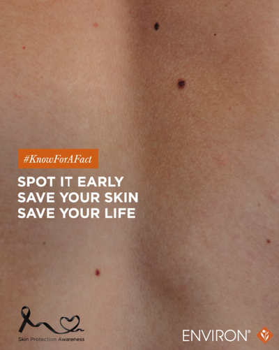 The image features a close-up of human skin with several dark moles and small red spots, overlaid with text promoting early detection for skin health.