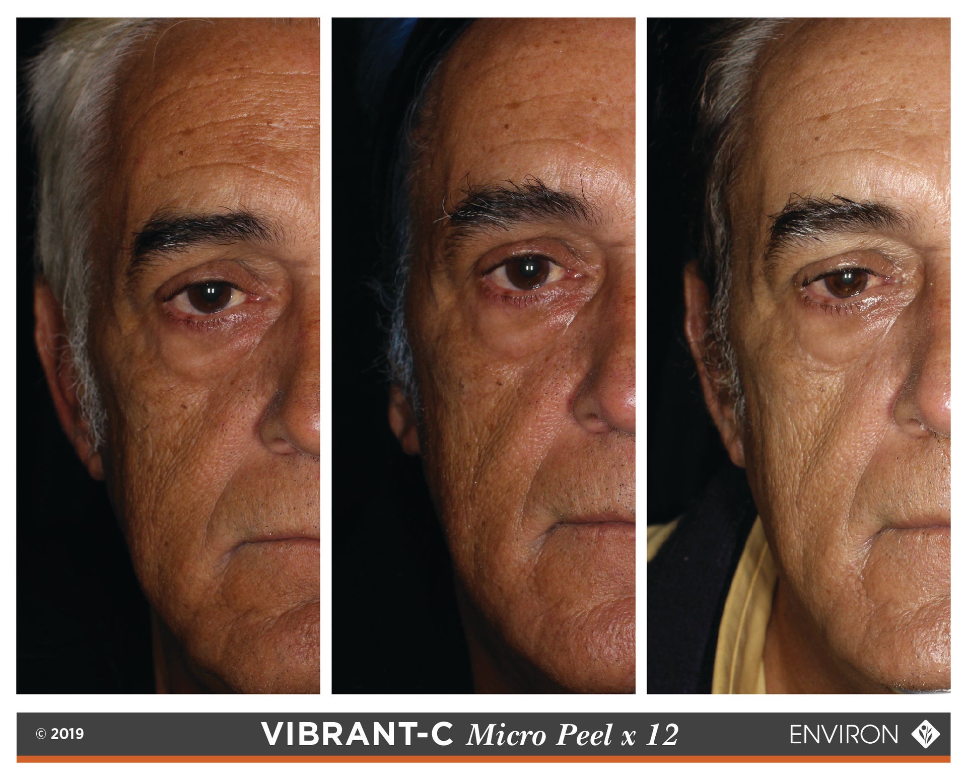 Vibrant-c micro peel treatment kit by environ.