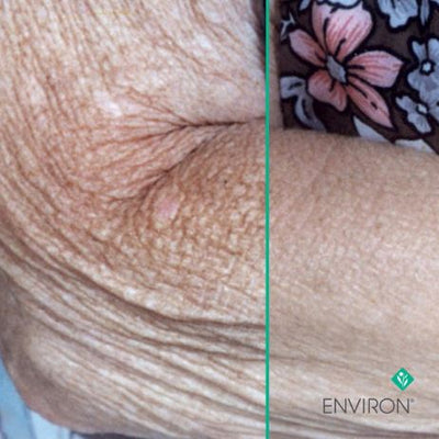 The image displays a split comparison of skin texture, with the left side showing aged, wrinkled skin and the right side showcasing smoother, younger-looking skin.