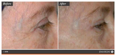 The ’before’ and ’after’ comparison image showcases the results of an environ skincare treatment on a person’s eye area, highlighting improved skin texture and reduced fine lines.