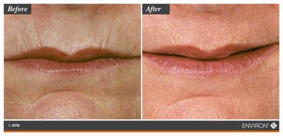The image shows a before-and-after comparison of lips, with the ’after’ side appearing smoother and more hydrated.