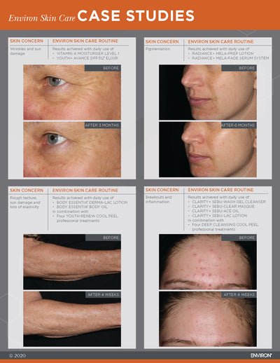 Environ skin care case study brochure showcasing before-and-after skin improvement results for wrinkles, pigmentation, rough texture, and breakouts using their specialized skincare routines.