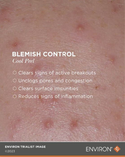 Skin with visible blemishes and redness, shown as part of a product demonstration for environ’s blemish control cool peel.