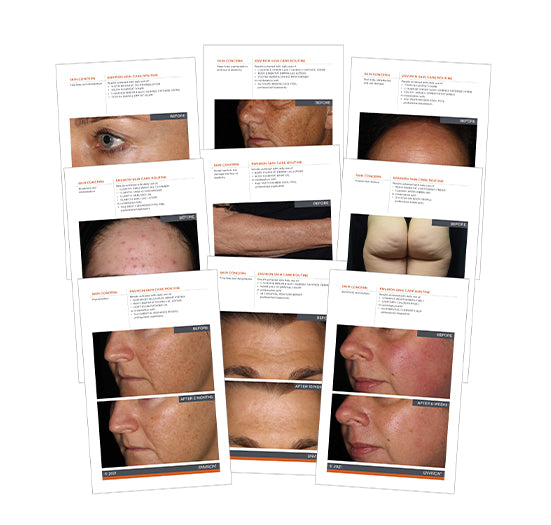 A collection of Environ skincare case studies displays dramatic before and after results for common skin concerns like aging, sun damage, and acne.